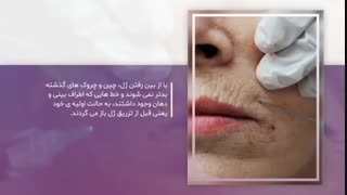 تولید محتوا | مای کاستومر | مرکز لیزر سان اسکین