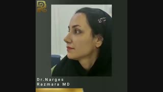 جراحی بینی با انحراف شدید و نامتقارنی سوارخ های بینی