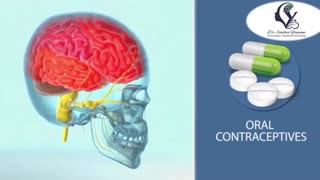 نکاتی درباره میگرن