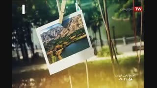 شال _ حجت اشرف زاده لیفت گردنایمپلنت دندان