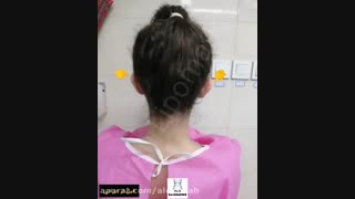 جراحی اتوپلاستی