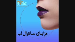 مزایای سانترال لب