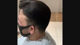 پروتز موقت مو  09198858620