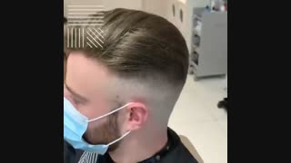 پروتز مو یا کاشت مو  09198858620