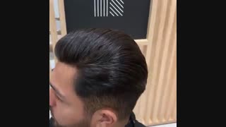 پروتز مو تا چند سال دوام دارد  09198858620