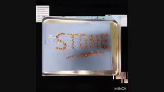 ویدئو عمل PCNL و خارج کردن سنگ کلیه