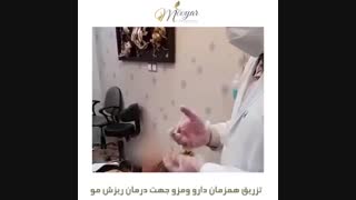 تزریق همزمان دارو و مزو جهت درمان ریزش مو