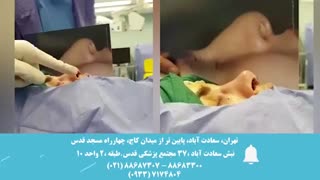 جراحی زیبایی بینی