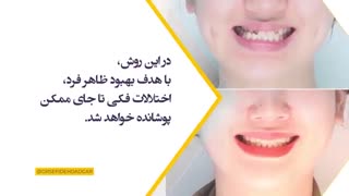 ارتودنسی جبرانی | دکتر سپیده دادگر