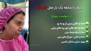 جراحی بینی ترمیمی مشکل با سابقه چند بار جراحی و سوراخ تیغه بینی | دکتر باستانی نژاد