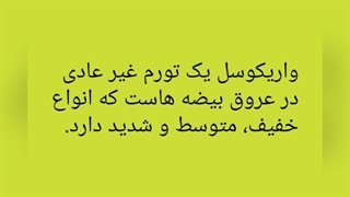 واریس بیضه ها در مردان ( واریکوسل)