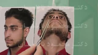 رفع مشکلات زیبایی و تنفسی با رینوپلاستی