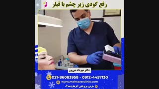 رفع گودی زیر چشم با تزریق فیلر