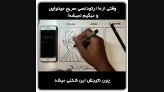 اینو بفرست برای کسایی که دنبال نتیجه سریع از درمان ارتودنسی هستند | دکترسعید قریشی