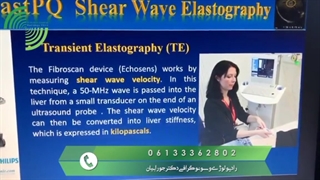 فیبرواسکن کبد چرب را دقیق نشان می دهد و یا الاستوگرافی ؟