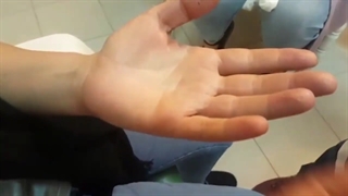 تشخیص آلرژی تماسی پوست