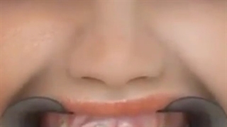 ارتو فیکس