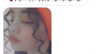 نمونه کار واقعی عمل بینی بعد از 16 روز
