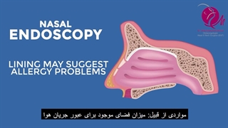 آندوسکوپى بینى