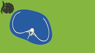 انیمیشن جالب اسکولیوز