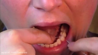 آموزش استفاده صحیح از نخ دندان