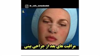 مراقبت های بعد از جراحی بینی