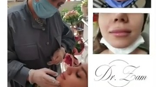 لب های جذاب شما ۵