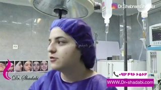 بلافاصله پس از جراحی بینی