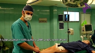 انحراف شدید زانو در اطفال