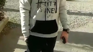 تعویض مجدد مفصل ران در جوان ۱۸ ساله