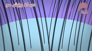 چگونگی ریزش مو