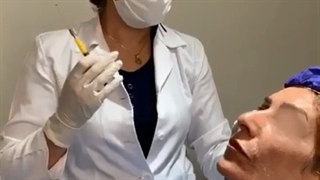 تزریق چربی نانوفت به صورت