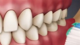 روش صحیح مسواک زدن | کلینیک تخصصی دندانپزشکی کانسپتا