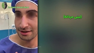 جراحی فانکشنال راینوپلاستی با ظاهر کاملا مردانه | دکتر باستانی نژاد