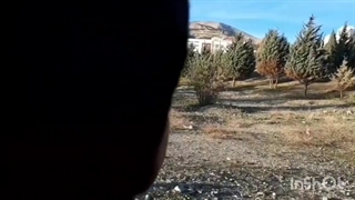 محمدی کشیدن دندان