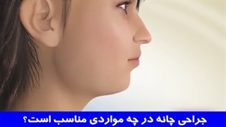 جراحی چانه در چه زمانی مناسب است؟ | دکتر احسان مهریزی لیفت پیشانی