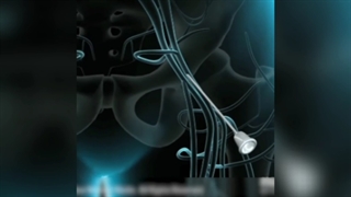 آنژیوگرافی قلب