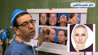 فیلم عمل لیفت صورت به همراه تزریق چربی در خانم 60 ساله