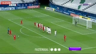 گل رامین رضاییان کاشت ابرو