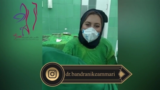 فیلم عمل لابیاپلاستی در دختران باکره