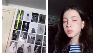 بیلی یا بی تی اس؟