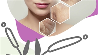 همه چیز درباره میکرونیدلینگ برداشتن خال