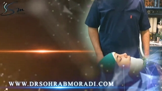 عمل زیبایی بینی