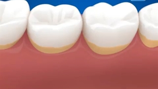 تفاوت مسواک برقی با مسواک معمولی