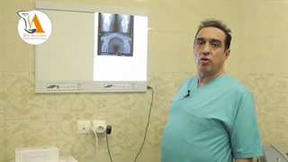 ساییدگی مفاصل