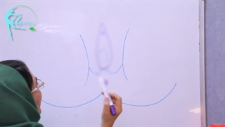 پرینورافی