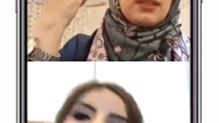 محدودیت سنی بلفاروپلاستی