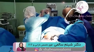زایمان سزارین ودرمان دارویی جهت کاهش ذخیره تخمدان