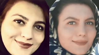 نمونه جراحی بینی گوشتی
