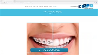 روزهای اول ارتودنسی ثابت